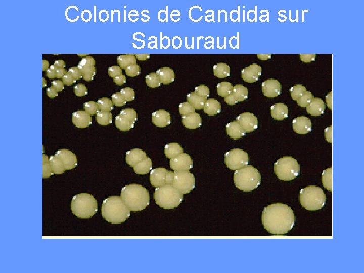 Colonies de Candida sur Sabouraud 