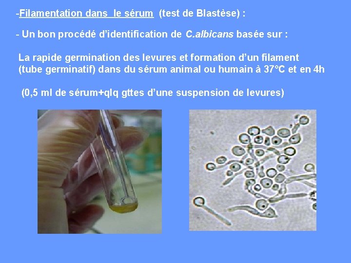 -Filamentation dans le sérum (test de Blastèse) : - Un bon procédé d’identification de