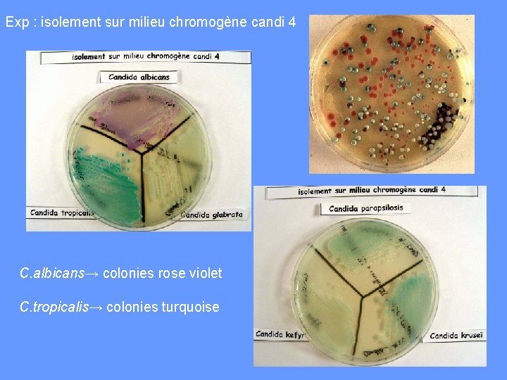 Exp : isolement sur milieu chromogène candi 4 C. albicans→ colonies rose violet C.