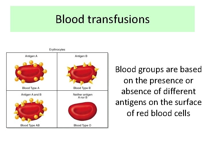Blood transfusions Blood groups are based on the presence or absence of different antigens
