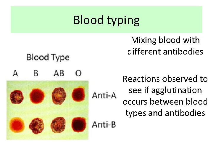 Blood typing Mixing blood with different antibodies Reactions observed to see if agglutination occurs