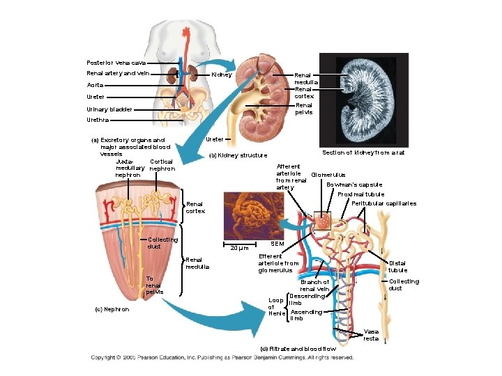 Posterior vena cava Renal artery and vein Kidney Renal medulla Renal cortex Renal pelvis