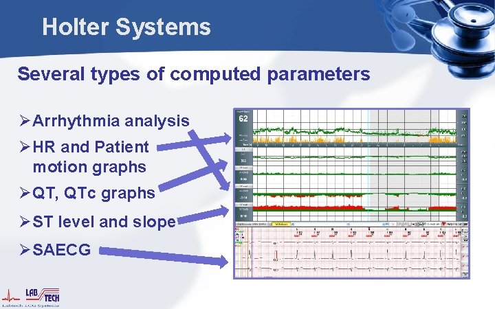 Holter Systems Several types of computed parameters ØArrhythmia analysis ØHR and Patient motion graphs