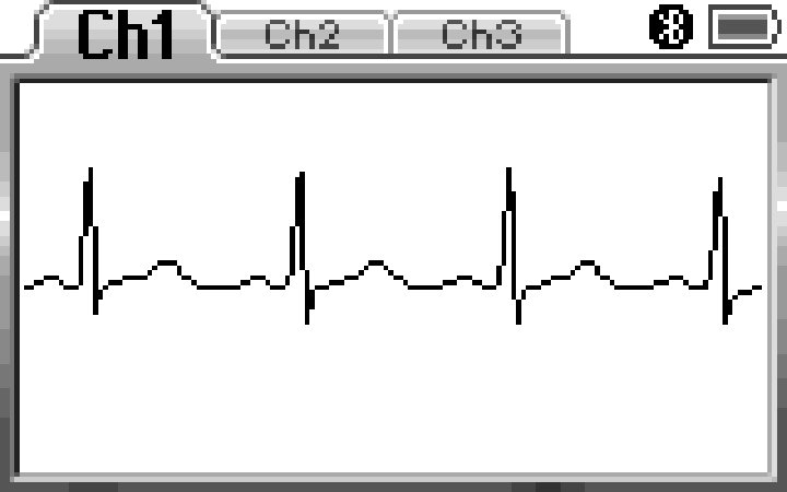 Holter Systems ØRecording duration: 24, 48, 72 hours, 1 week ØRecording rate: 128, 256,