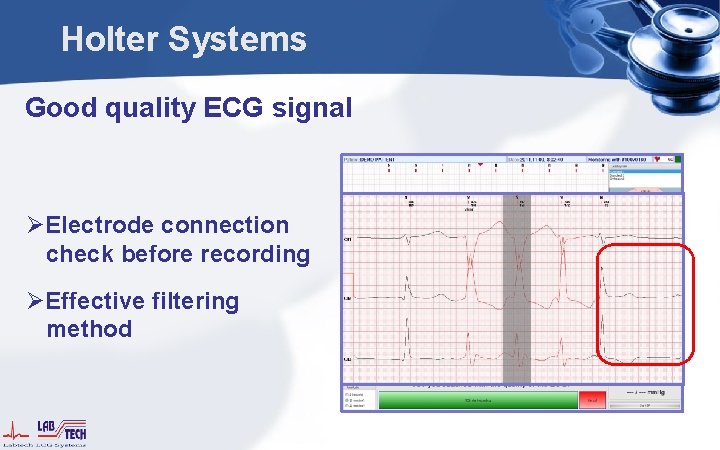 Holter Systems Good quality ECG signal ØElectrode connection check before recording ØEffective filtering method