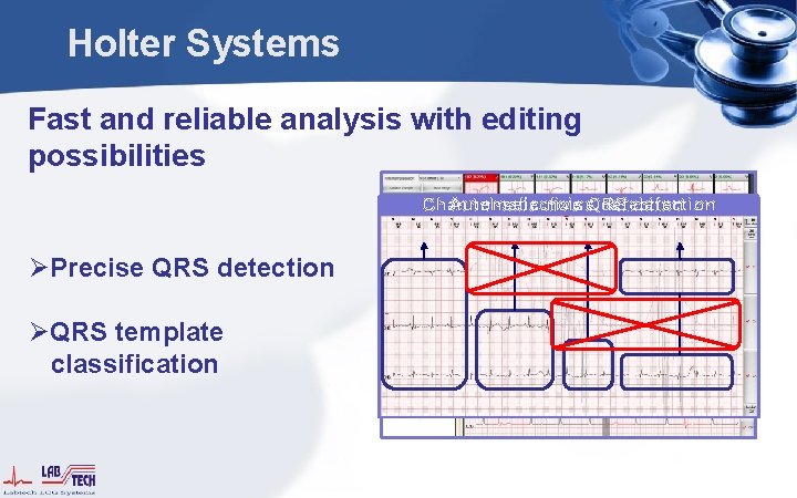 Holter Systems Fast and reliable analysis with editing possibilities Channel-selective Automatic noise. QRS detection