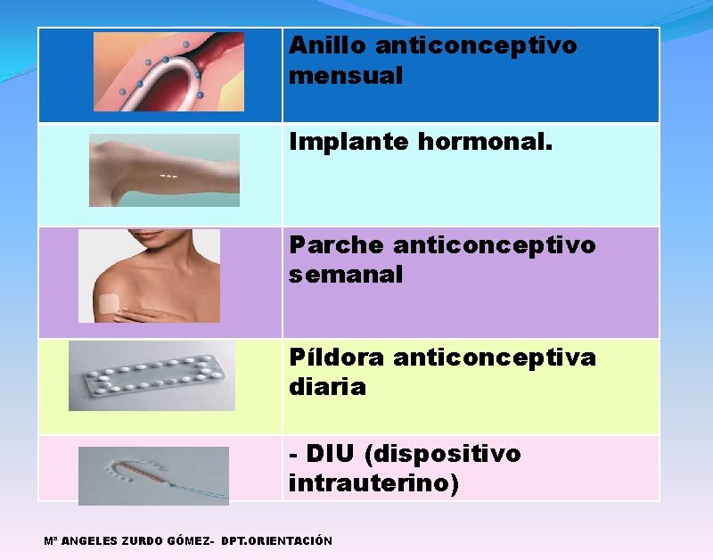 Anillo anticonceptivo mensual Implante hormonal. Parche anticonceptivo semanal Píldora anticonceptiva diaria - DIU (dispositivo