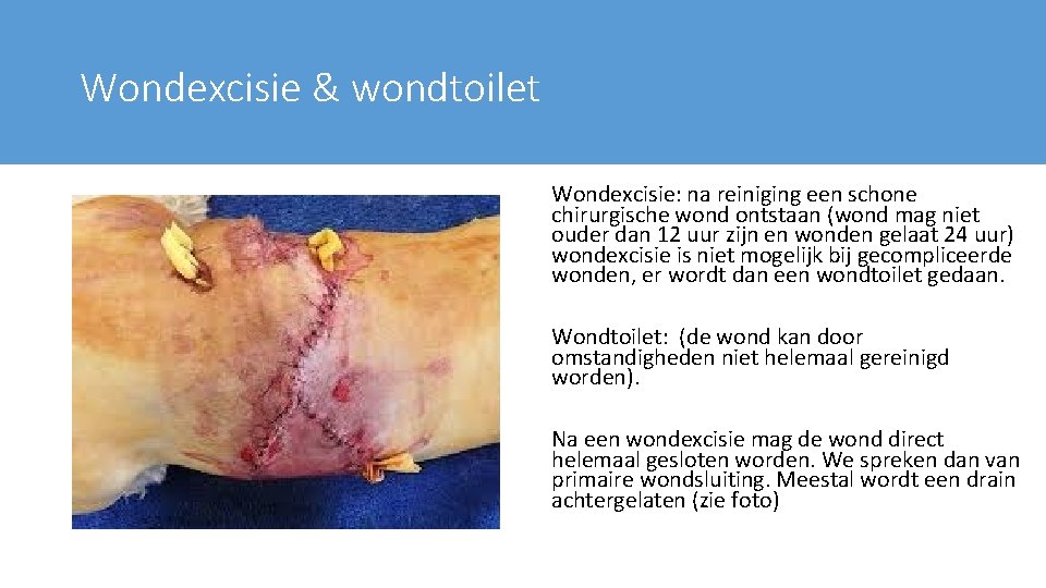 Wondexcisie & wondtoilet Wondexcisie: na reiniging een schone chirurgische wond ontstaan (wond mag niet