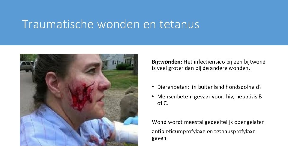 Traumatische wonden en tetanus Bijtwonden: Het infectierisico bij een bijtwond is veel groter dan