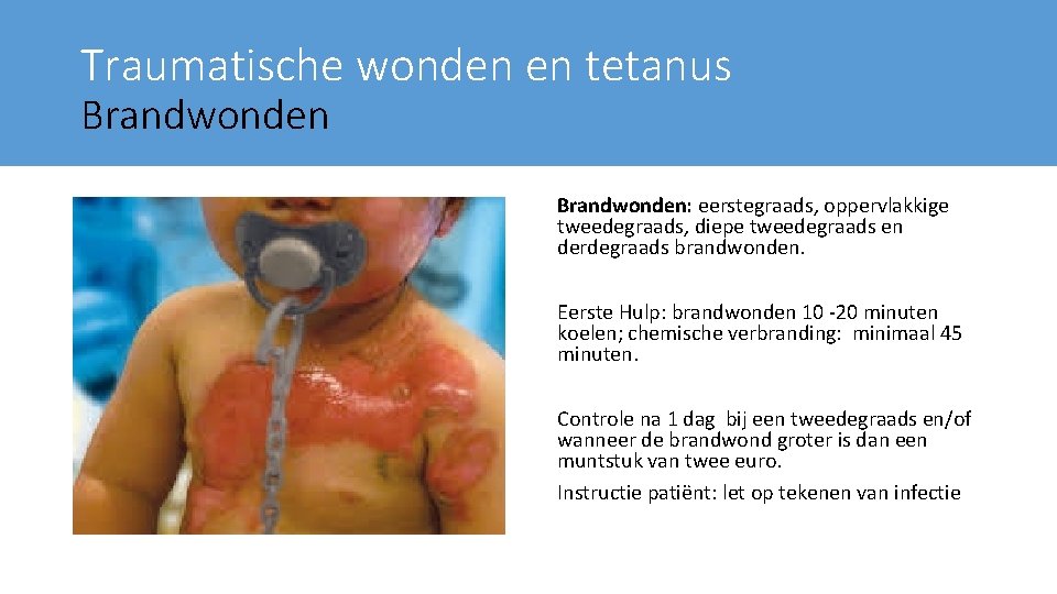 Traumatische wonden en tetanus Brandwonden: eerstegraads, oppervlakkige tweedegraads, diepe tweedegraads en derdegraads brandwonden. Eerste