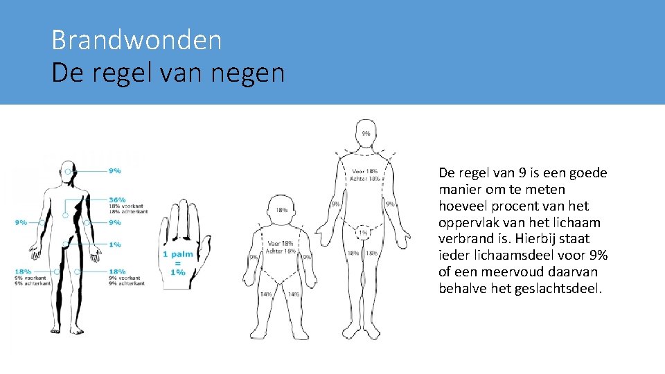 Brandwonden De regel van negen De regel van 9 is een goede manier om