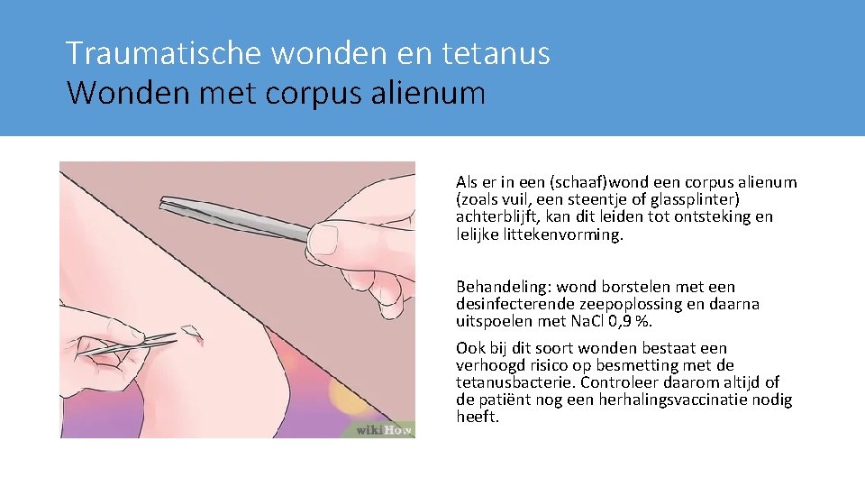 Traumatische wonden en tetanus Wonden met corpus alienum Als er in een (schaaf)wond een