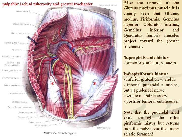 After the removal of the Gluteus maximus muscle it is clearly seen that Gluteus