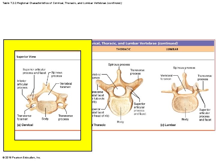 Table 7. 2 -2 Regional Characteristics of Cervical, Thoracic, and Lumbar Vertebrae (continued) © Table 7. 2 -2 Regional Characteristics of Cervical, Thoracic, and Lumbar Vertebrae (continued) ©