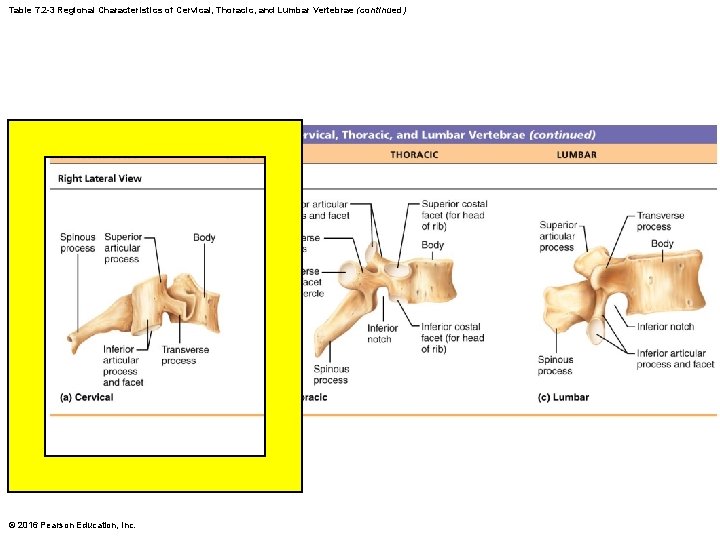 Table 7. 2 -3 Regional Characteristics of Cervical, Thoracic, and Lumbar Vertebrae (continued) © Table 7. 2 -3 Regional Characteristics of Cervical, Thoracic, and Lumbar Vertebrae (continued) ©