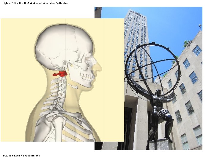 Figure 7. 20 a The first and second cervical vertebrae. C 1 Posterior Vertebral Figure 7. 20 a The first and second cervical vertebrae. C 1 Posterior Vertebral