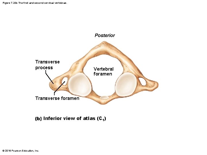 Figure 7. 20 b The first and second cervical vertebrae. Posterior Transverse process Vertebral Figure 7. 20 b The first and second cervical vertebrae. Posterior Transverse process Vertebral