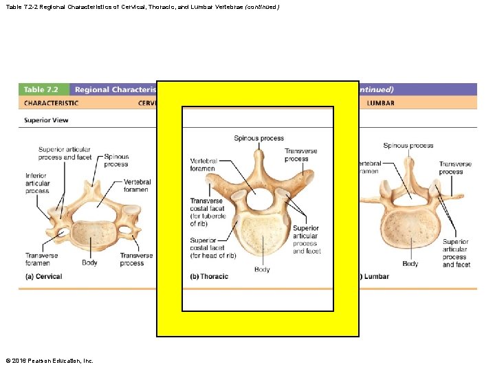 Table 7. 2 -2 Regional Characteristics of Cervical, Thoracic, and Lumbar Vertebrae (continued) © Table 7. 2 -2 Regional Characteristics of Cervical, Thoracic, and Lumbar Vertebrae (continued) ©