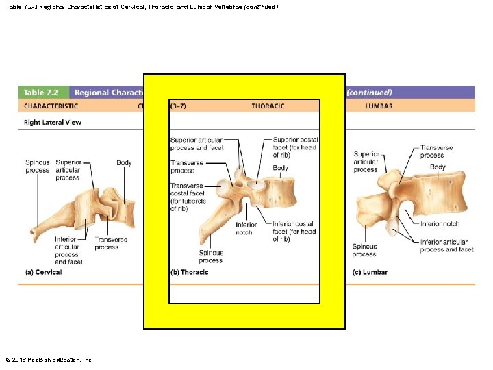 Table 7. 2 -3 Regional Characteristics of Cervical, Thoracic, and Lumbar Vertebrae (continued) © Table 7. 2 -3 Regional Characteristics of Cervical, Thoracic, and Lumbar Vertebrae (continued) ©