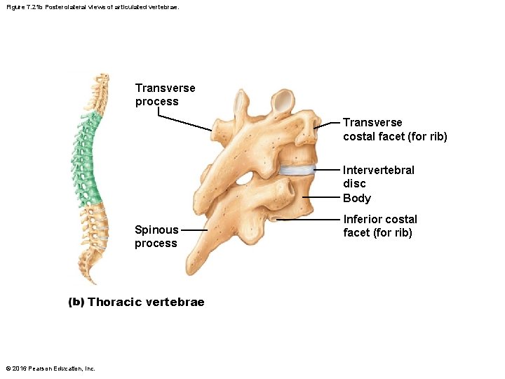 Figure 7. 21 b Posterolateral views of articulated vertebrae. Transverse process Transverse costal facet Figure 7. 21 b Posterolateral views of articulated vertebrae. Transverse process Transverse costal facet