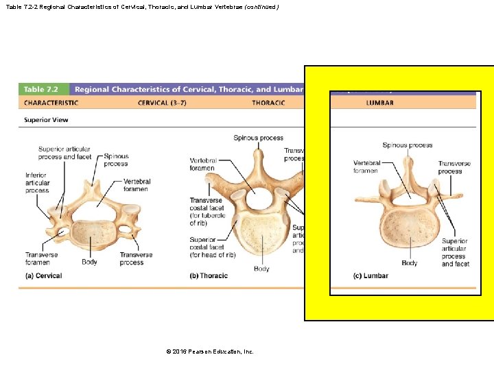 Table 7. 2 -2 Regional Characteristics of Cervical, Thoracic, and Lumbar Vertebrae (continued) © Table 7. 2 -2 Regional Characteristics of Cervical, Thoracic, and Lumbar Vertebrae (continued) ©