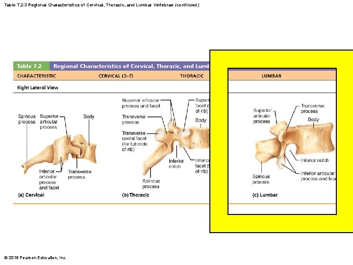 Table 7. 2 -3 Regional Characteristics of Cervical, Thoracic, and Lumbar Vertebrae (continued) © Table 7. 2 -3 Regional Characteristics of Cervical, Thoracic, and Lumbar Vertebrae (continued) ©
