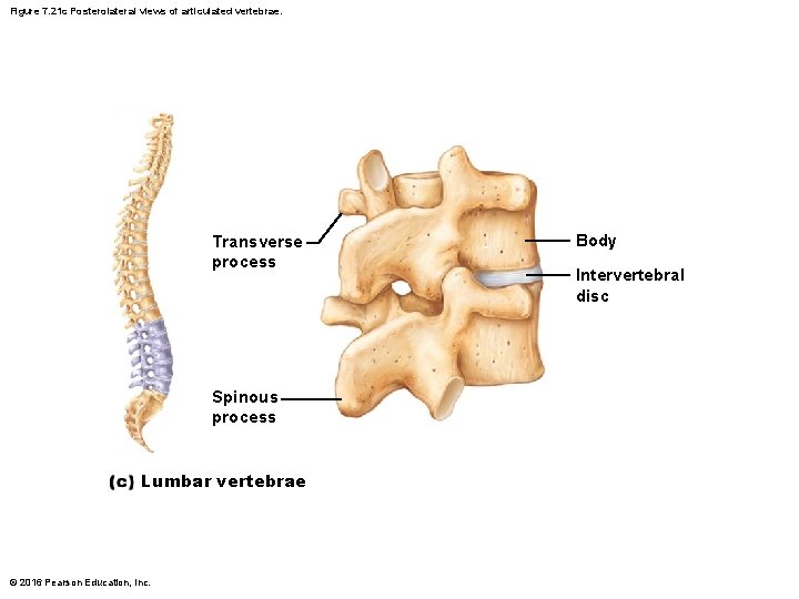 Figure 7. 21 c Posterolateral views of articulated vertebrae. Transverse process Spinous process Lumbar Figure 7. 21 c Posterolateral views of articulated vertebrae. Transverse process Spinous process Lumbar