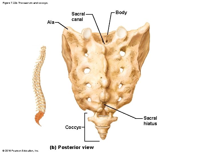 Figure 7. 22 b The sacrum and coccyx. Ala Sacral canal Coccyx © 2016 Figure 7. 22 b The sacrum and coccyx. Ala Sacral canal Coccyx © 2016