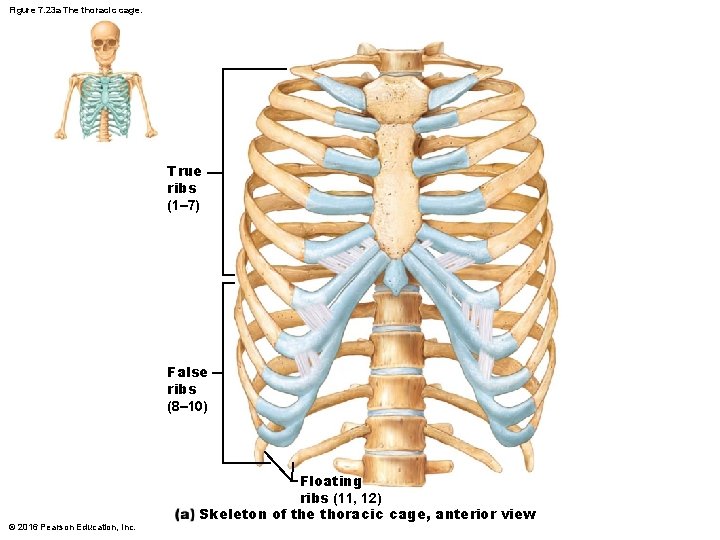 Figure 7. 23 a The thoracic cage. True ribs (1– 7) False ribs (8– Figure 7. 23 a The thoracic cage. True ribs (1– 7) False ribs (8–
