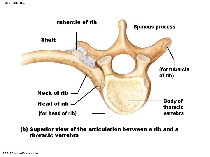 Figure 7. 24 b Ribs. tubercle of rib Spinous process Shaft (for tubercle of Figure 7. 24 b Ribs. tubercle of rib Spinous process Shaft (for tubercle of