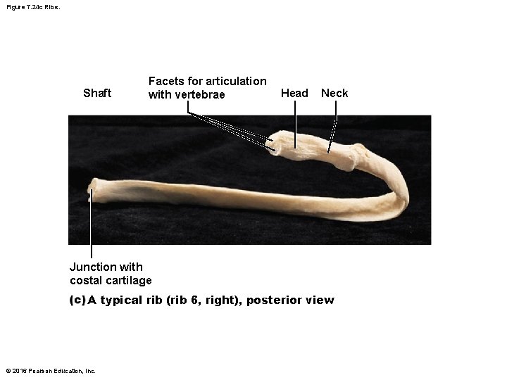 Figure 7. 24 c Ribs. Shaft Facets for articulation with vertebrae Head Neck Junction Figure 7. 24 c Ribs. Shaft Facets for articulation with vertebrae Head Neck Junction