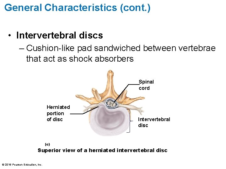 General Characteristics (cont. ) • Intervertebral discs – Cushion-like pad sandwiched between vertebrae that General Characteristics (cont. ) • Intervertebral discs – Cushion-like pad sandwiched between vertebrae that