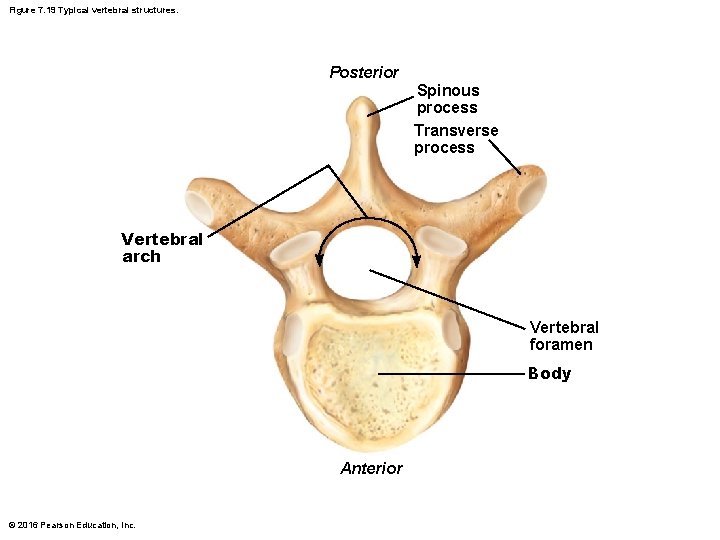 Figure 7. 19 Typical vertebral structures. Posterior Spinous process Transverse process Vertebral arch Vertebral Figure 7. 19 Typical vertebral structures. Posterior Spinous process Transverse process Vertebral arch Vertebral