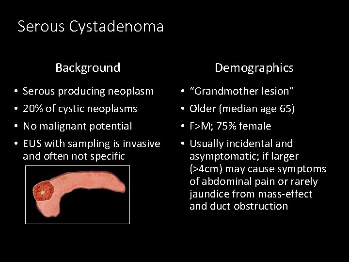 Serous Cystadenoma Background • • Serous producing neoplasm 20% of cystic neoplasms No malignant