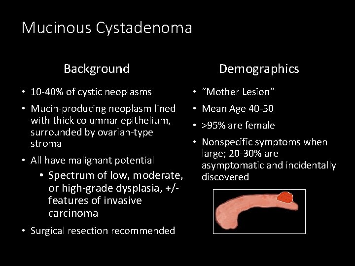 Mucinous Cystadenoma Background Demographics • 10 -40% of cystic neoplasms • “Mother Lesion” •