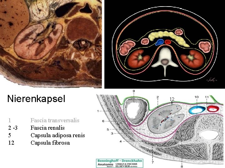 Nierenkapsel 1 2 -3 5 12 Fascia transversalis Fascia renalis Capsula adiposa renis Capsula