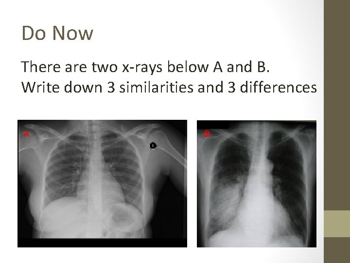 Do Now There are two x-rays below A and B. Write down 3 similarities