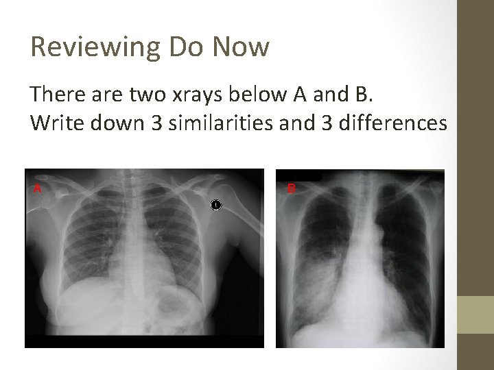 Reviewing Do Now There are two xrays below A and B. Write down 3