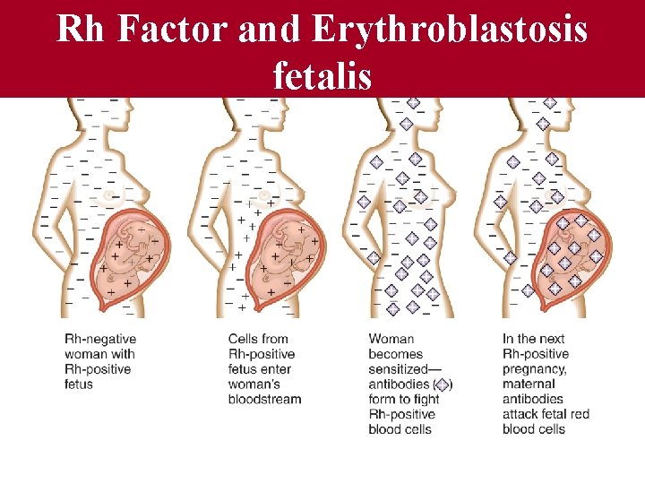 Fig 12. 19 Rh Factor and Erythroblastosis fetalis 