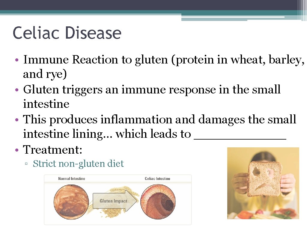 Celiac Disease • Immune Reaction to gluten (protein in wheat, barley, and rye) •