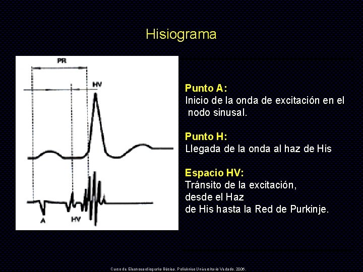 Hisiograma Punto A: Inicio de la onda de excitación en el nodo sinusal. Punto