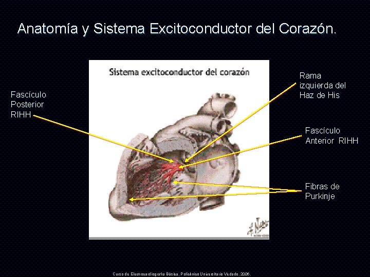 Anatomía y Sistema Excitoconductor del Corazón. Rama izquierda del Haz de His Fascículo Posterior