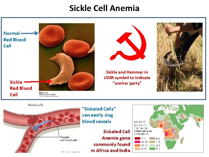 Sickle Cell Anemia Normal Red Blood Cell Sickle and Hammer in USSR symbol to Sickle Cell Anemia Normal Red Blood Cell Sickle and Hammer in USSR symbol to