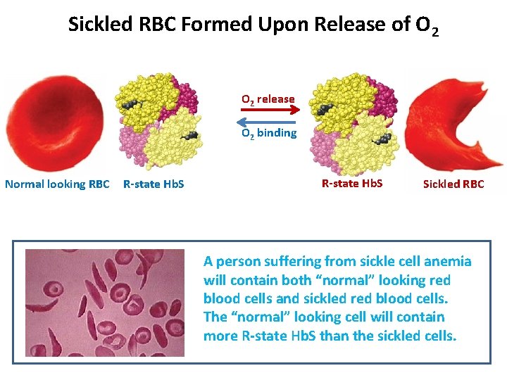 Sickled RBC Formed Upon Release of O 2 release O 2 binding Normal looking Sickled RBC Formed Upon Release of O 2 release O 2 binding Normal looking