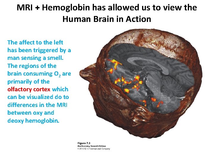 MRI + Hemoglobin has allowed us to view the Human Brain in Action The MRI + Hemoglobin has allowed us to view the Human Brain in Action The