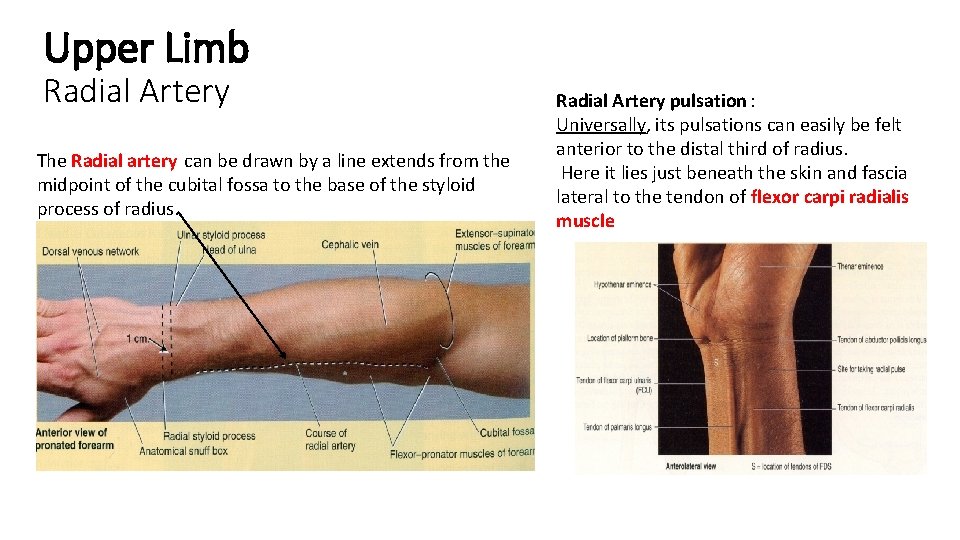 Upper Limb Radial Artery The Radial artery can be drawn by a line extends