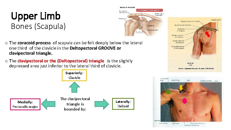 Upper Limb Bones (Scapula) Extra o The coracoid process of scapula can be felt