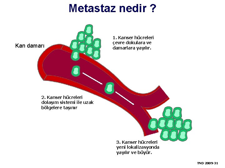 Metastaz nedir ? 1. Kansercells hücreleri 1. Cancer çevre surrounding dokulara ve invade damarlara
