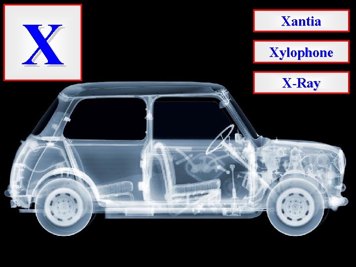 X Xantia Xylophone X-Ray 