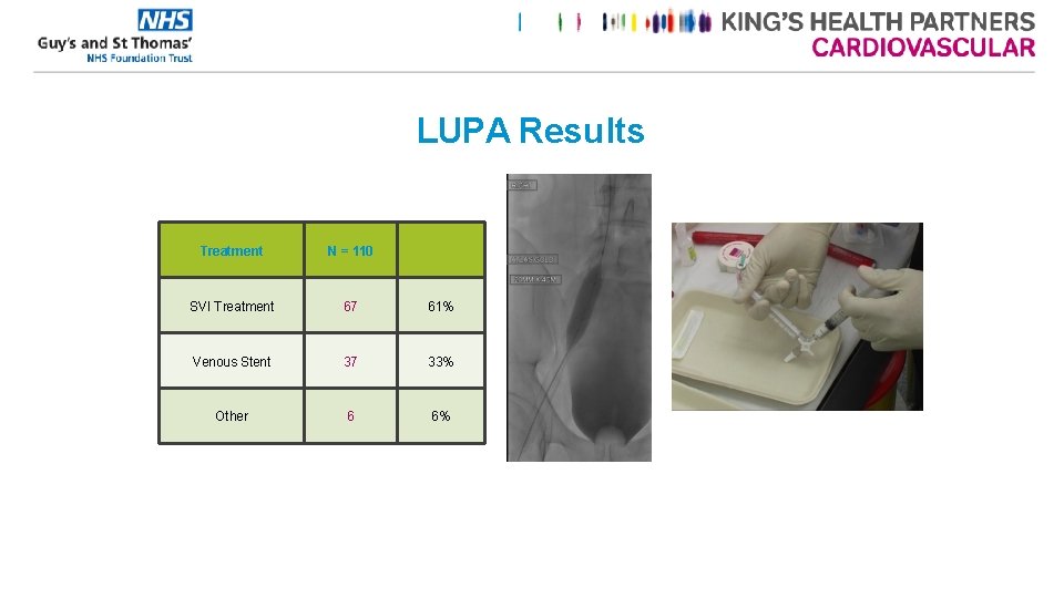 LUPA Results Treatment N = 110 SVI Treatment 67 61% Venous Stent 37 33%